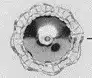 BP C2342 L 18MM RD